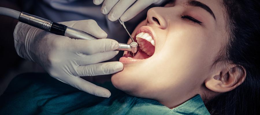 Top Signs You Need a Root Canal Treatment Before It’s Too Late