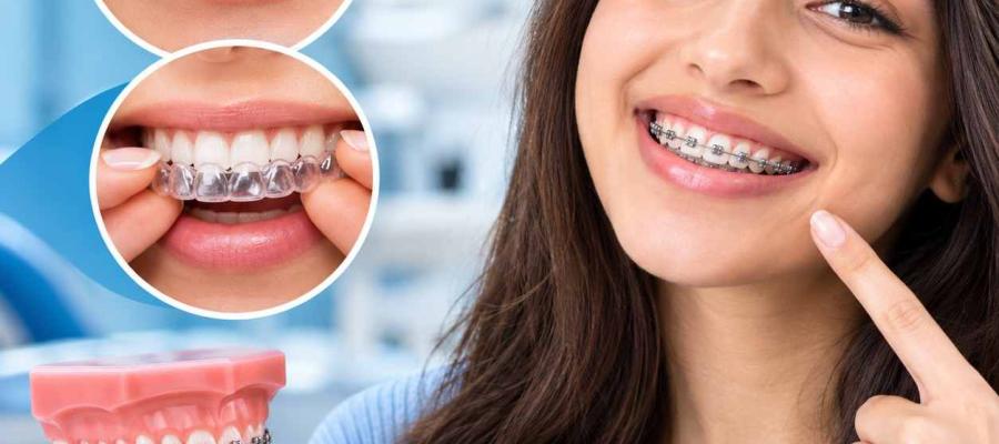 Braces & Aligners Services Braces & Aligners Services