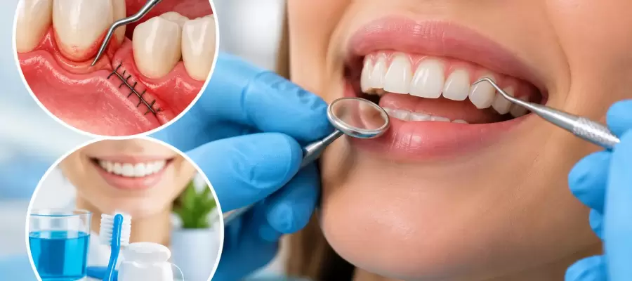 How to Care for Your Gums After Periodontal Surgery How to Care for Your Gums After Periodontal Surgery