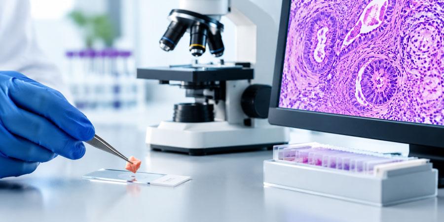 Biopsy & Histopathological Reporting